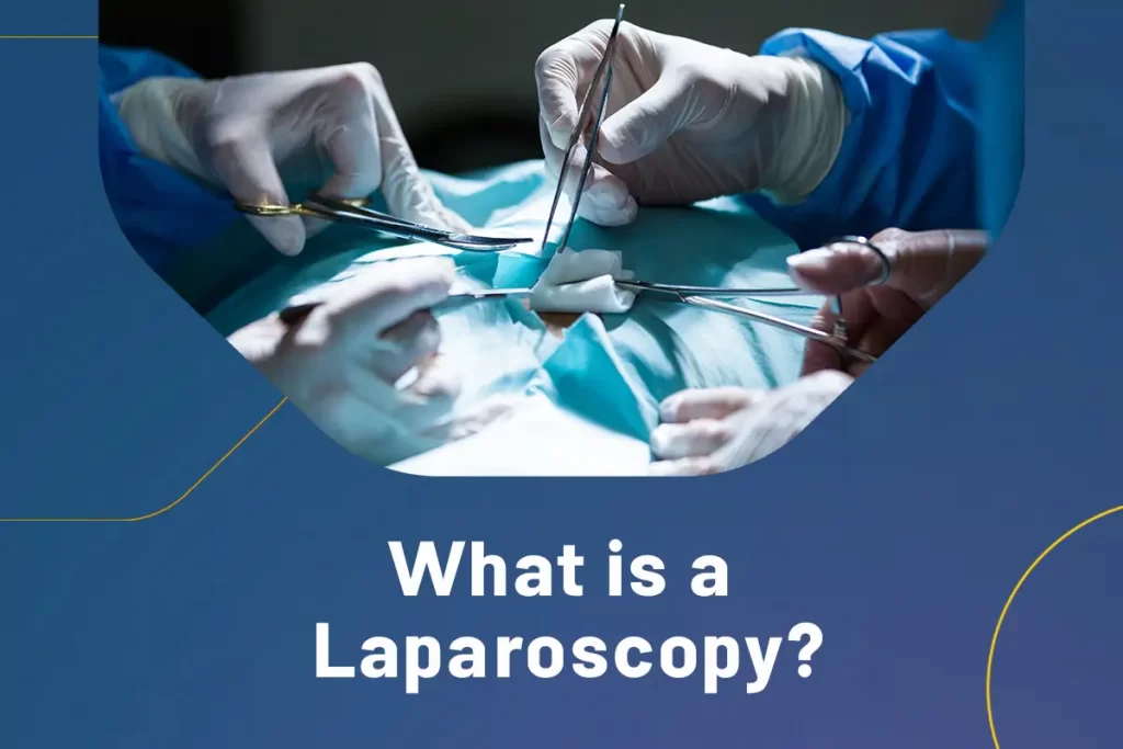 What is a Laparoscopy